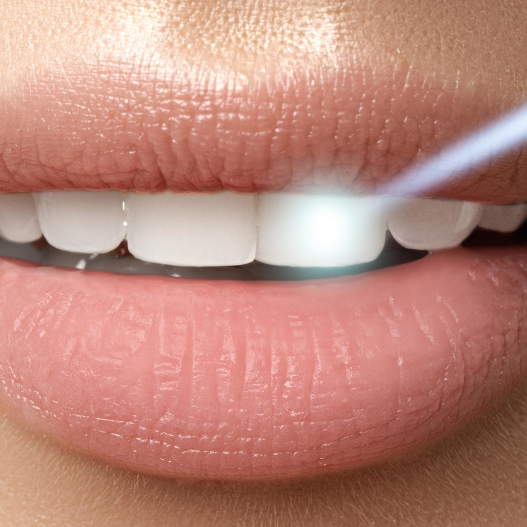 Natural Teeth Whitening
